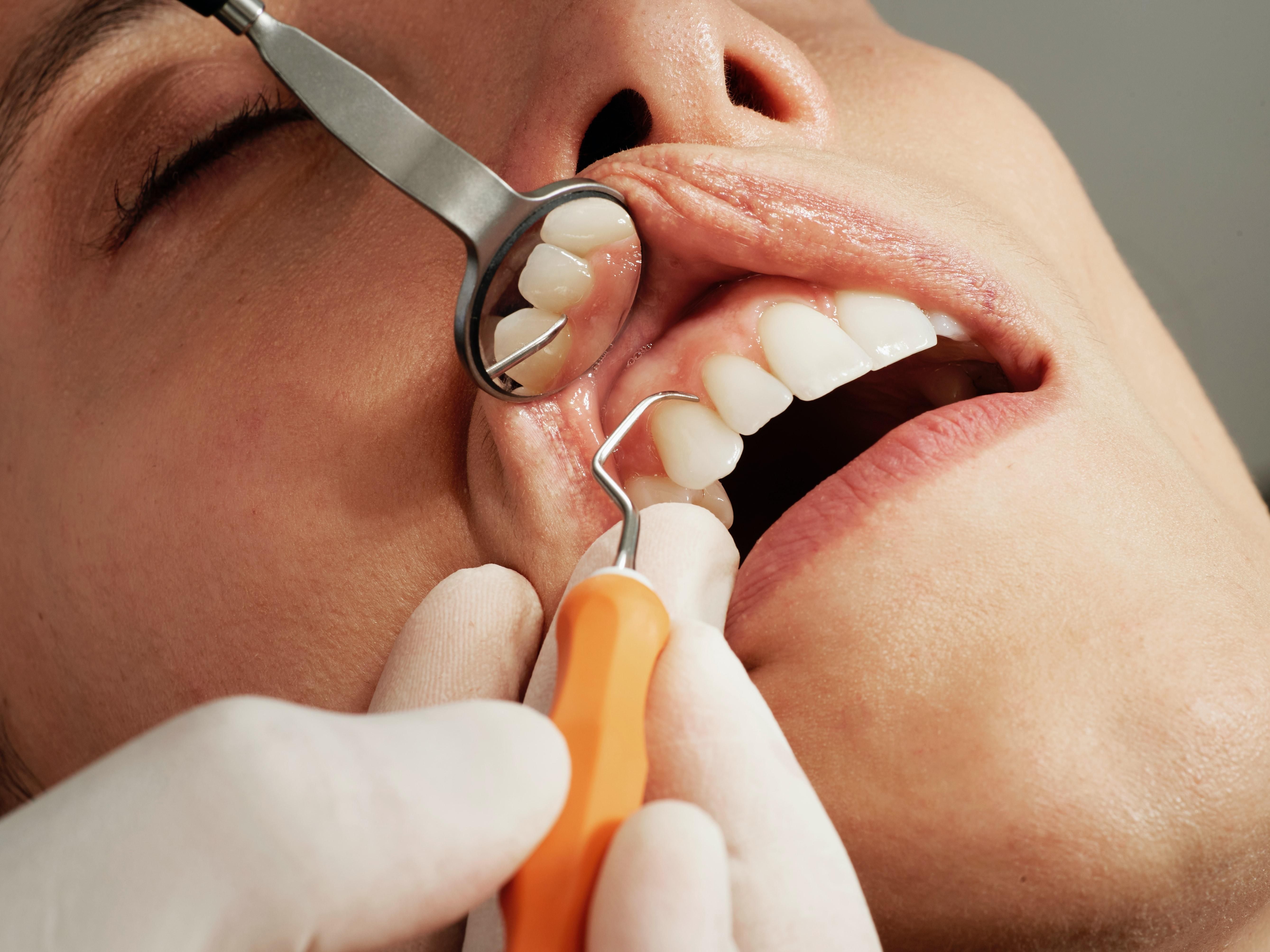 Фахівці зі сфери здоров'я рекомендують відвідувати стоматолога двічі на рік