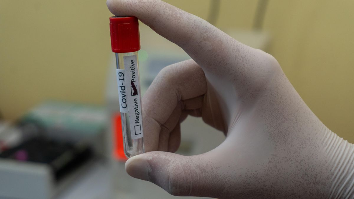 У Чехії запровадять обов'язкове тестування на коронавірус для працівників: з якої дати - Закордон