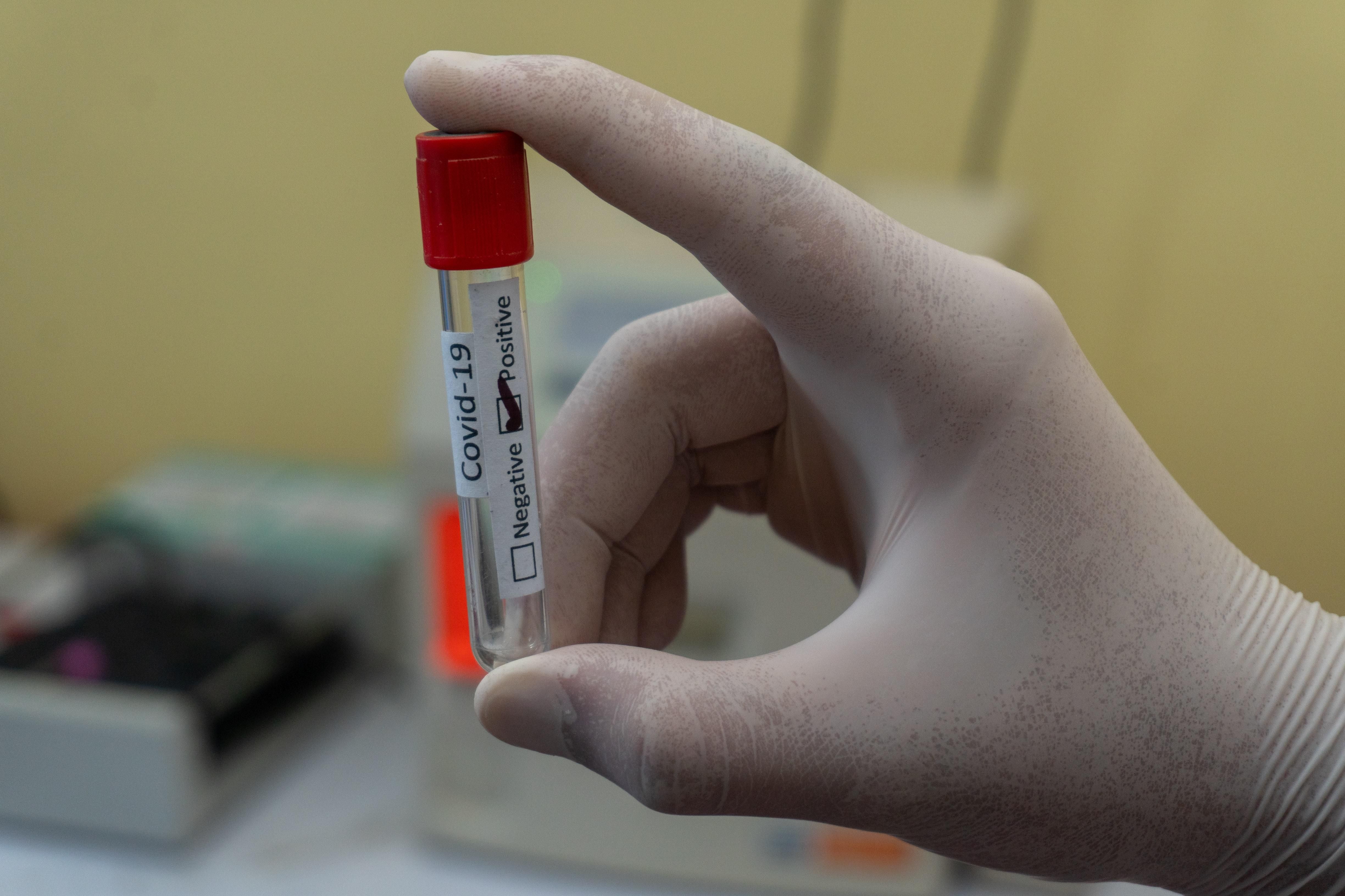 У Чехії запровадять обов'язкове тестування на коронавірус для працівників: з якої дати - Закордон