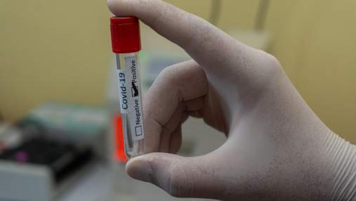 У Чехії запровадять обов'язкове тестування на коронавірус для працівників: з якої дати 
